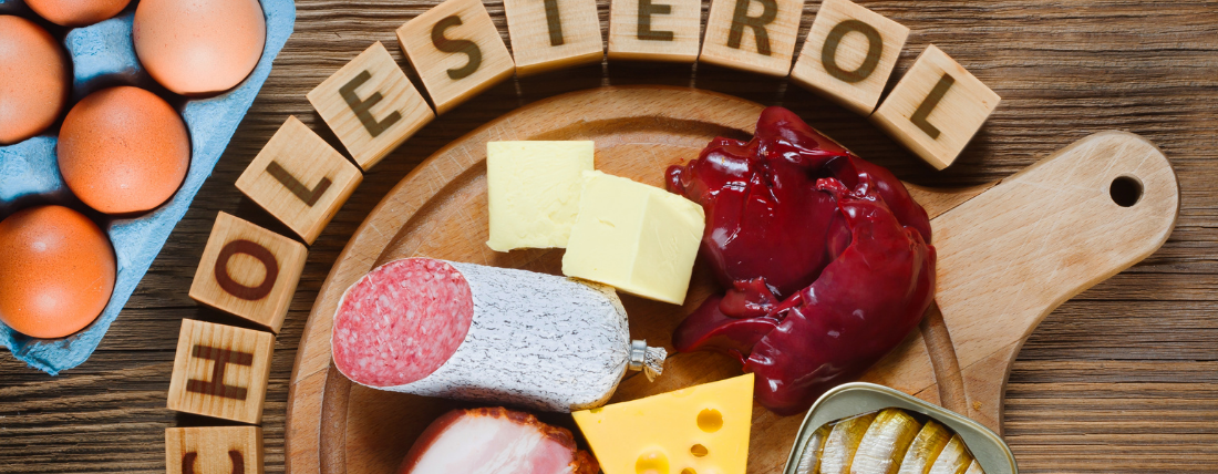 Does Cholesterol Really Cause Heart Disease?
